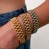 Top 2 | Watch Bracelet